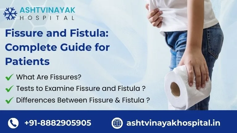 Fissure and Fistula: Complete Guide for Patients